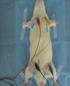 ⼼电图采集与解析系统插图4