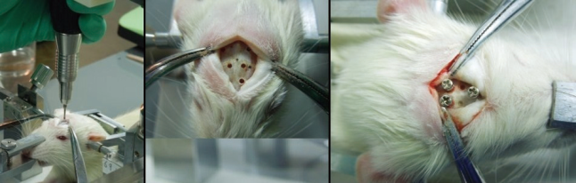 钻头插图2 钻头插图2