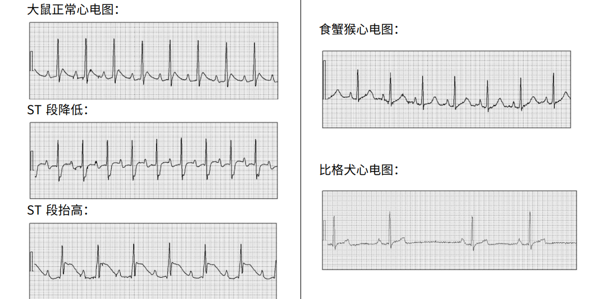 ⼼电图采集与解析系统插图12