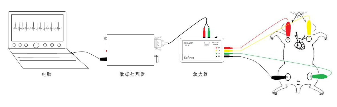 ⼼电图采集与解析系统插图
