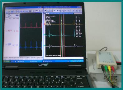 ⼼电图采集与解析系统插图1