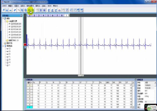 ⼼电图采集与解析系统插图3