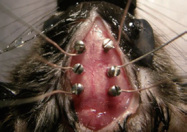 脑电螺钉插图1 脑电螺钉插图1