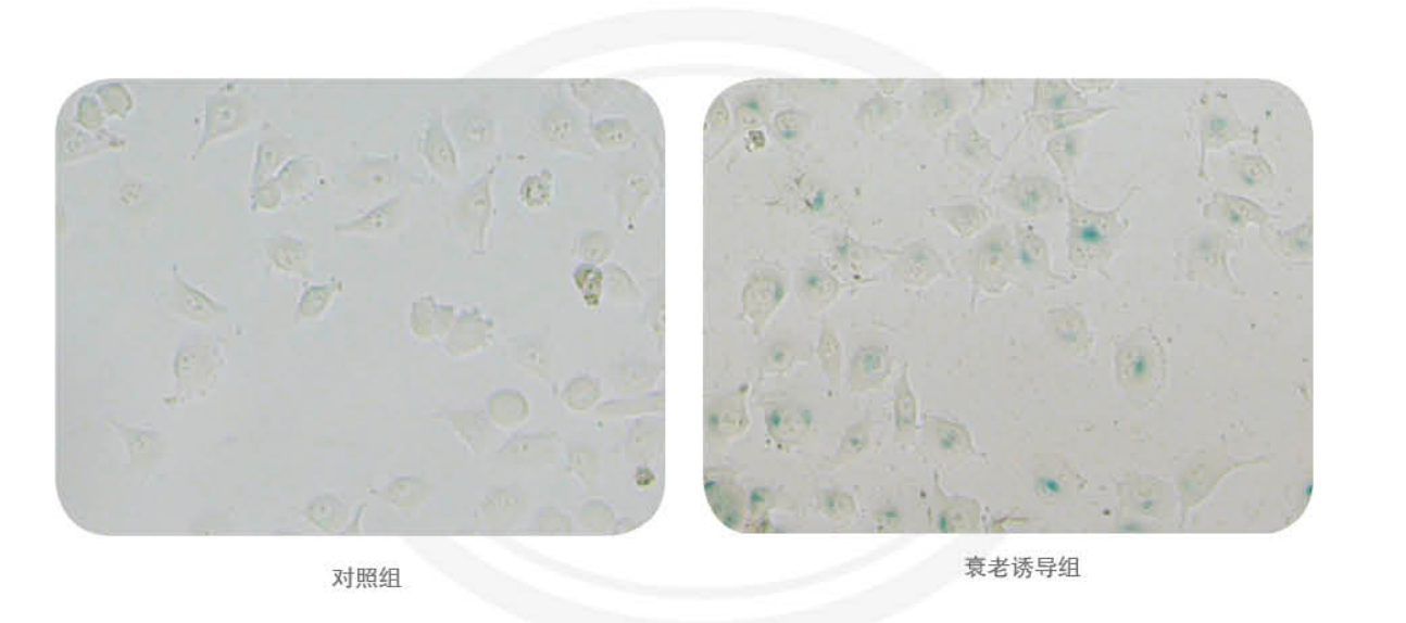 细胞衰老检测试剂盒插图 细胞衰老检测试剂盒插图