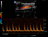 小动物超声影像系统插图2