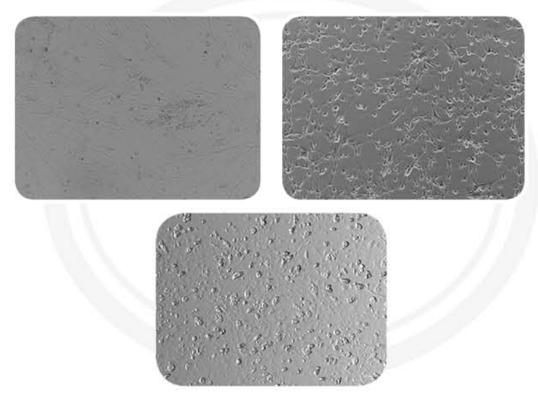 干细胞诱导分化培养基插图 干细胞诱导分化培养基插图