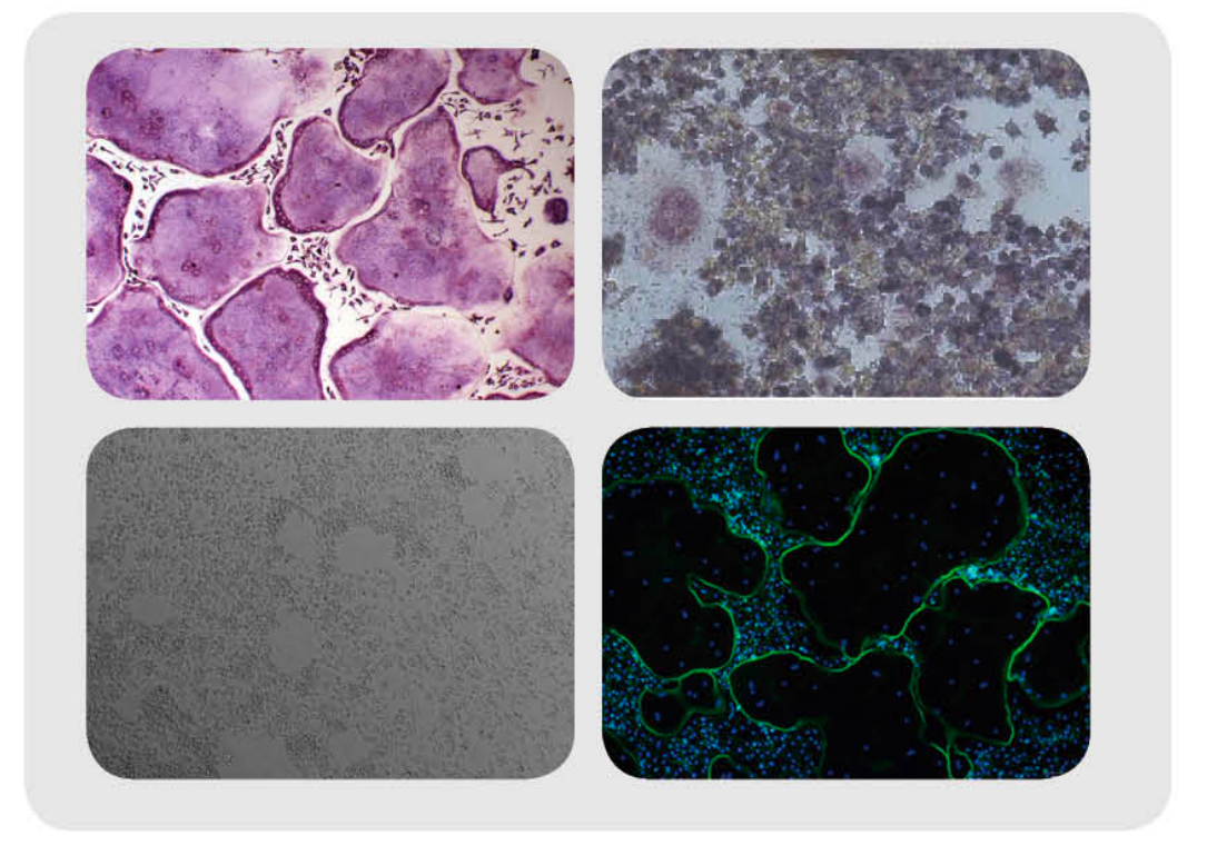 破骨细胞诱导培养基及TRAP签定试剂盒插图 破骨细胞诱导培养基及TRAP签定试剂盒插图