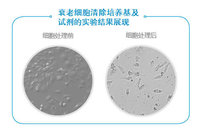 衰老细胞清除培养基及试剂插图 衰老细胞清除培养基及试剂插图